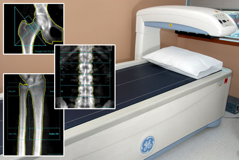 DXA scanning room and xray images of hip, spine, and leg